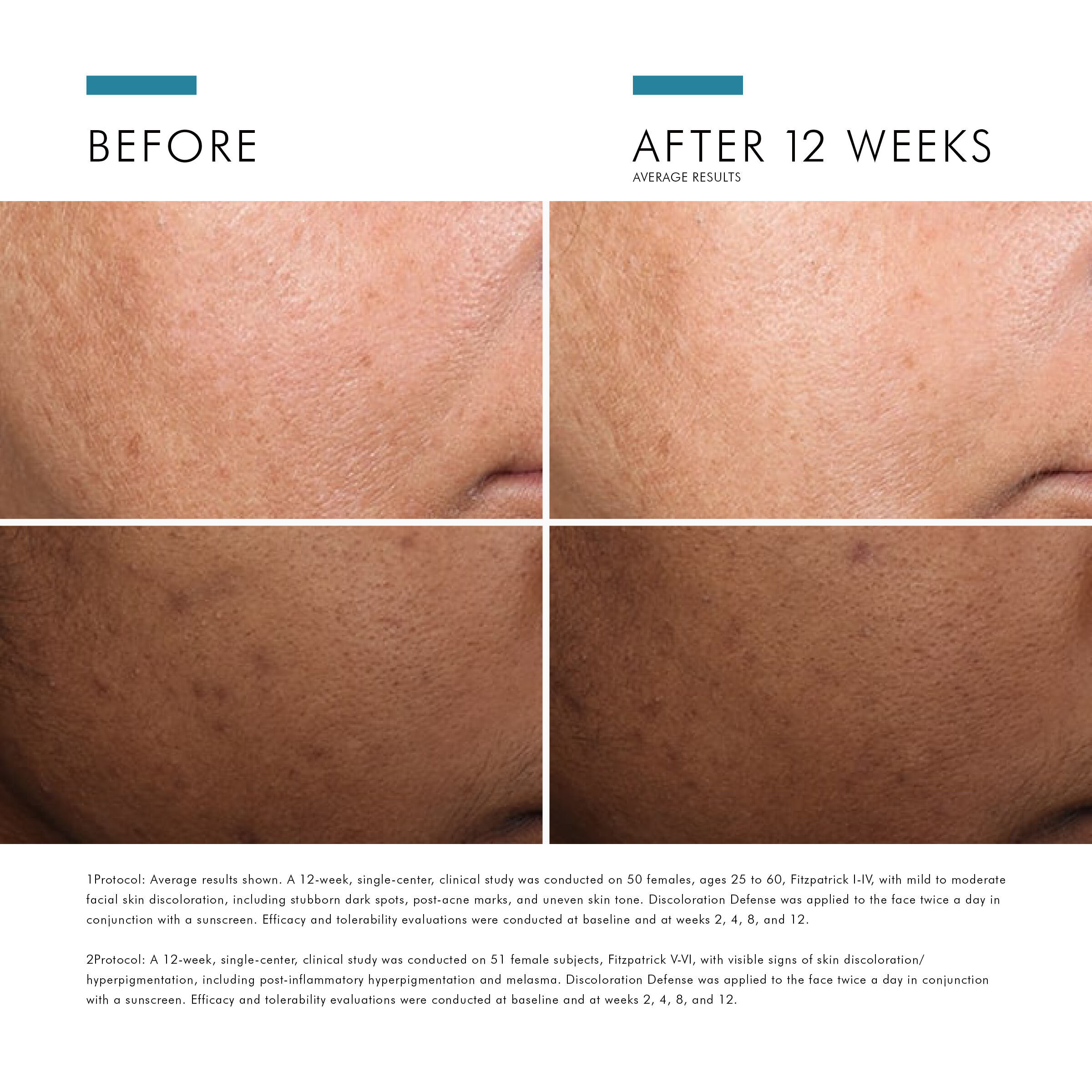 Discolouration Defense Dark Spot Corrector