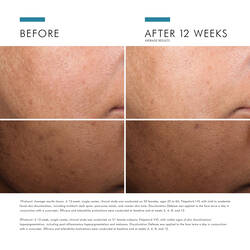 Discolouration Defense Dark Spot Corrector