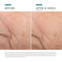 Triple Lipid Restore 242 Anti Aging Moisturiser