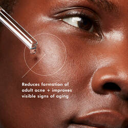 Blemish AGE Defense 30ml