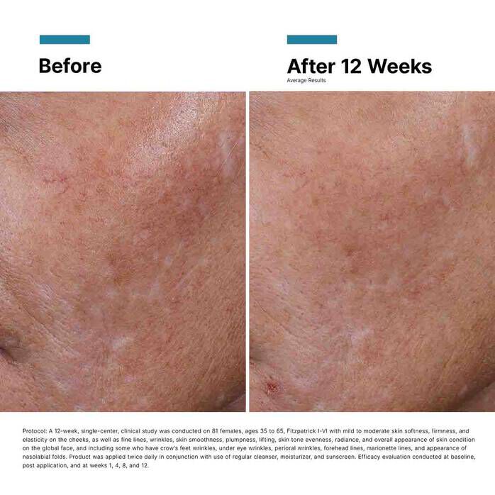 Hyaluronic Acid Intensifier Multi-Glycan​