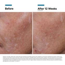 Hyaluronic Acid Intensifier Multi-Glycan​